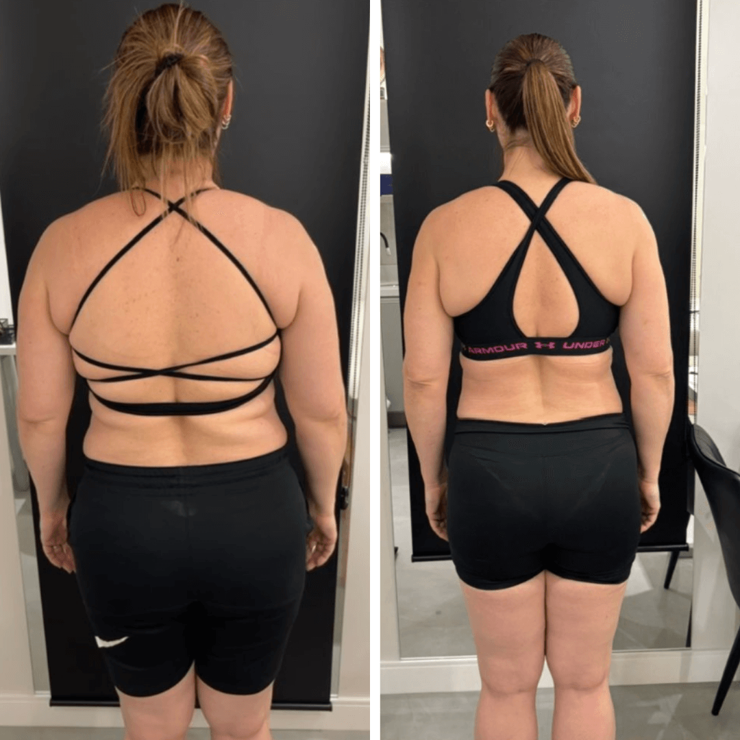 Resultado de transformação 1